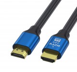 E-Zone Nagy sebességű HDMI kábel 2.0v, 4K, 60Hz, 1.5 méter, kompatibilis Apple TV, Samsung QLED TV, 3D-Xbox, PS4, fekete-kék