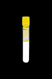 FL Medical s.r.l. Elysium vákuumos, steril, vizeletminta-vevő cső vákuumtűs vizeletpohárhoz - 16 x 100 mm - 10 ml - 1 db